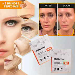 Kit  GoldBotox Highprime - Colágeno + Ácido Hialurônico + Ativos do Botox